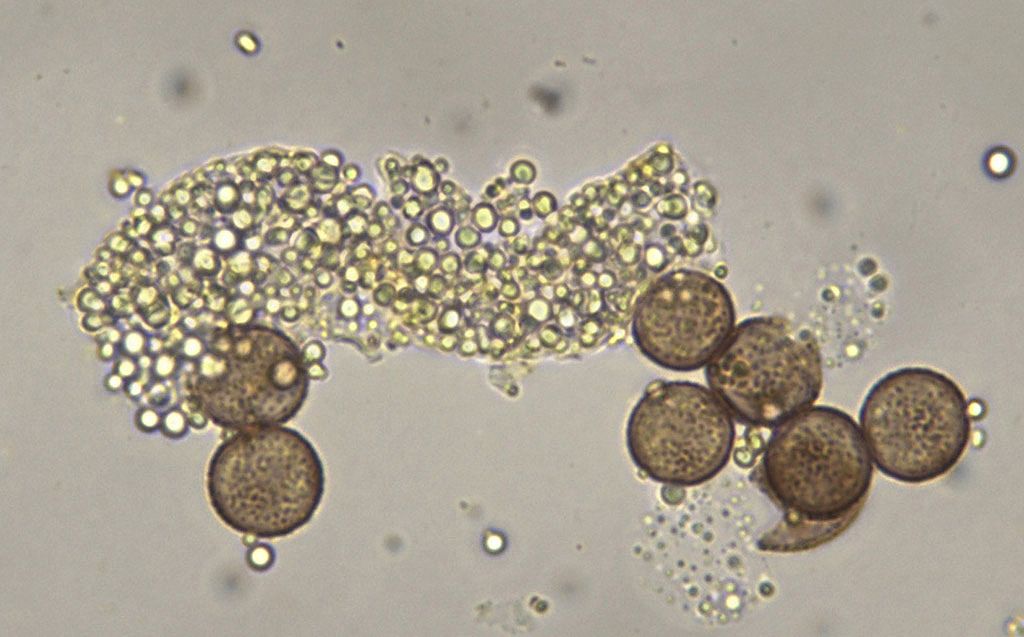 Physarum lateritium?